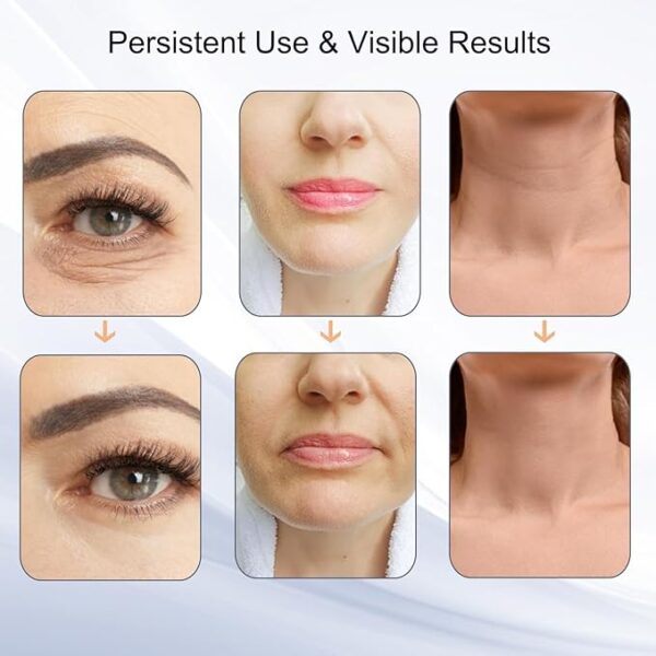 Facial Beauty Device,Facial Massager - Image 2